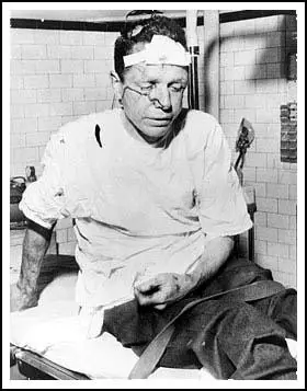 James Peck after being beaten at Anniston.