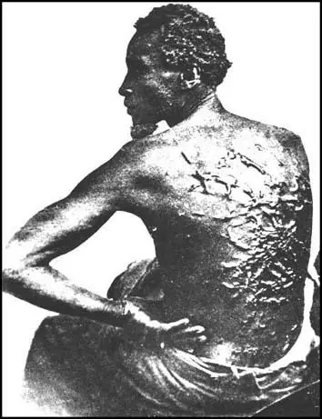 A whipped slave in the 1860s.